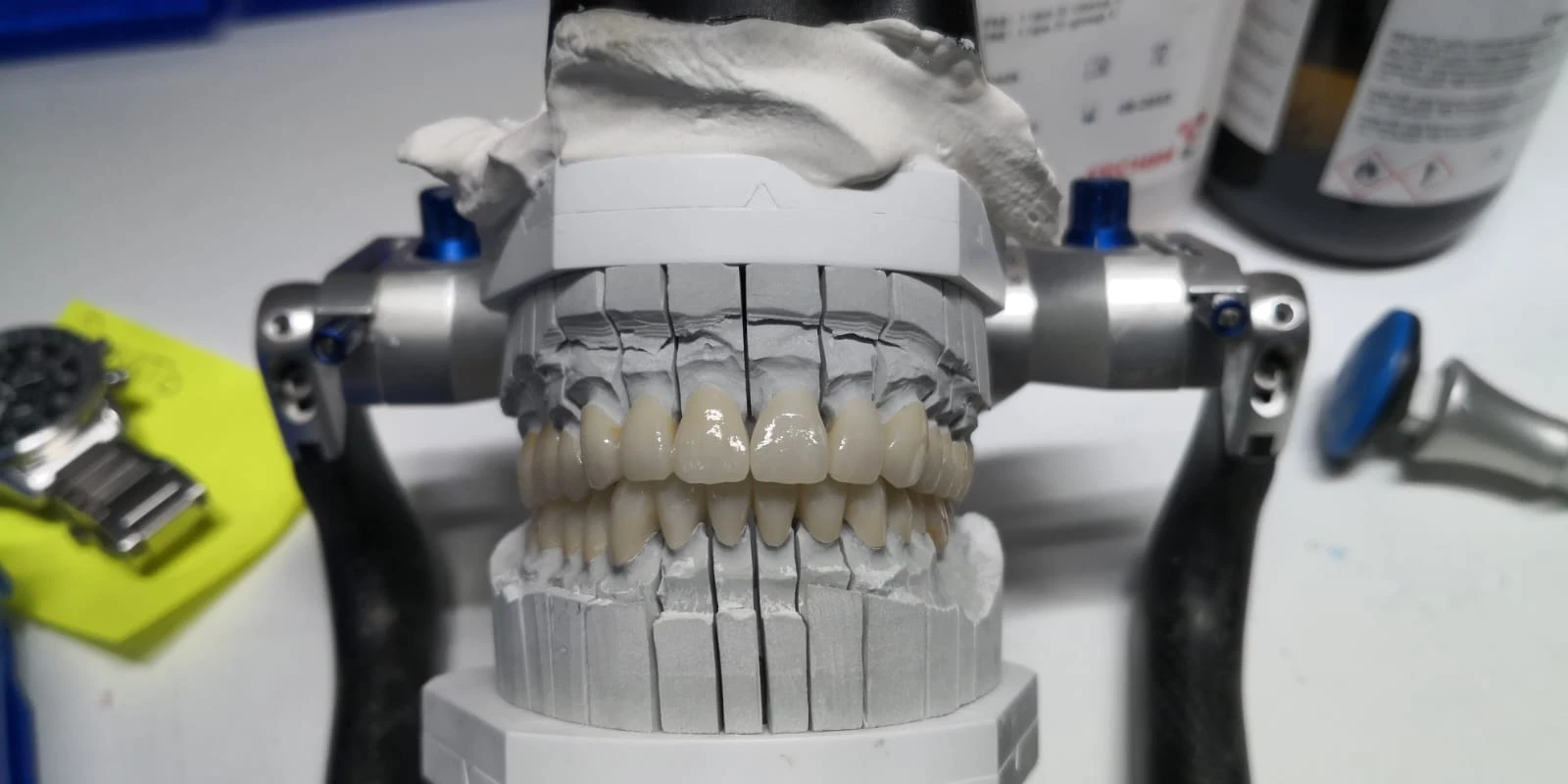 DB LAB 52 - LABORATORIO ODONTOTECNICO RICOSTRUZIONI E REALIZZAZIONE PONTI E CORONE DENTALI